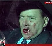 Užpuolikas smarkiai sužalojo Italijos premjero veidą.