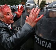 Protesto akcija Tiranoje virto kruvinomis kautynėmis.