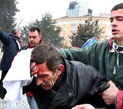 Protesto akcija Tiranoje virto kruvinomis kautynėmis.