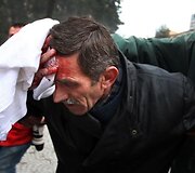 Protesto akcija Tiranoje virto kruvinomis kautynėmis.