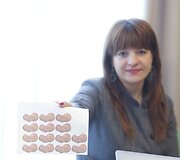 Pasaulinė žvynelinės diena