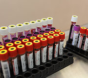 Kraujo centro jubiliejus