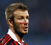 Futbolininkas planavo žaisti Anglijos rinktinės sudėtyje Pietų Afrikos Respublikoje