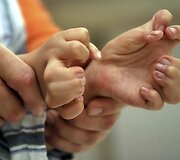 Jaunasis Kinijos gyventojas pasirengęs sudėtingai operacijai