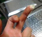 Sužeistą pir&scaron;tą prižiūrėtojas užklijavo lipnia juosta