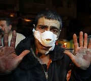 Sužeistas palestinietis rodo krauju i&scaron;teptas rankas.