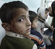 Sužeisti palestinos vaikai