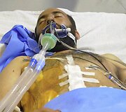 Gydomas per i&scaron;puolį sužeistas vyras