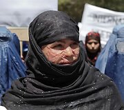 Proteste dalyvavo ir 16-metė mergina, kuriai už nei&scaron;tikimybę rūg&scaron;timi buvo nudegintas veidas