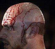 Sužeistas imtynininkas