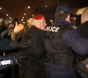 Bulgarijoje per protestus sužeistas vyras