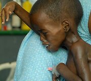 Somalyje nusilpęs vaikas