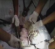 Kanalizacijos vamzdyje įstrigusio kūdikio gelbėjimo operacija