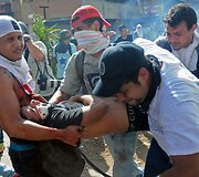 Ne&scaron;amas Venesueloje sužeistas protestuotojas 