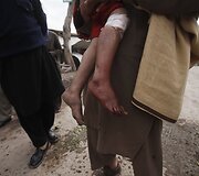 Pakistane per i&scaron;puolį sužeista mergaitė