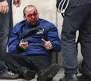 Sužeistas protestuotojas