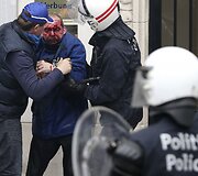Sužeistas protestuotojas