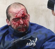 Sužeistas protestuotojas