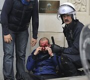 Sužeistas protestuotojas 