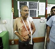 Per Izraelio bombardavimą Gazos Ruože sužeistas vyras