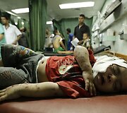 Per Izraelio bombardavimą Gazos Ruože sužeistas vaikas