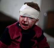 Damaske per raketų sprogimus sužeistas berniukas