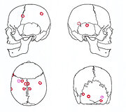 Kulkų įėjimo vietų schema, padaryta remiantis 16 palaikų duomenimis