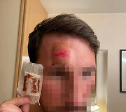 Paspirtuko vairuotojo konflikto su policijos pareigūnais padariniai