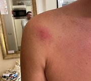 Paspirtuko vairuotojo konflikto su policijos pareigūnais padariniai