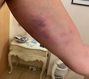 Paspirtuko vairuotojo konflikto su policijos pareigūnais padariniai