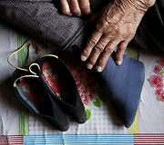 Buvusios &bdquo;paguodos moters&ldquo; Zhang Xiantu deformuotos kojos