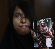 Naila Farhat, ją rūg&scaron;timi apipylė jos mokytojo sūnus, kuris jai pir&scaron;osi, bet tėvai atsisakė ją i&scaron;tekinti