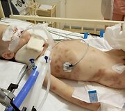 Tėvų sumu&scaron;tas vaikas