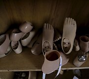 Studentai Sirijoje įrengė mobilią protezų gaminimo kliniką, kurios pagalbą pasiekia daugiau nukentėjusiųjų