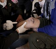Studentai Sirijoje įrengė mobilią protezų gaminimo kliniką, kurios pagalbą pasiekia daugiau nukentėjusiųjų