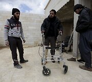 Studentai Sirijoje įrengė mobilią protezų gaminimo kliniką, kurios pagalbą pasiekia daugiau nukentėjusiųjų