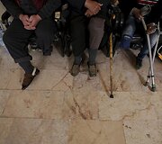 Studentai Sirijoje įrengė mobilią protezų gaminimo kliniką, kurios pagalbą pasiekia daugiau nukentėjusiųjų