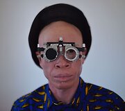 Ugandoje ir Tanzanijoje minėta Tarptautinė albinizmo diena