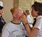 Ugandoje ir Tanzanijoje minėta Tarptautinė albinizmo diena