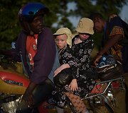 Ugandoje ir Tanzanijoje minėta Tarptautinė albinizmo diena