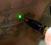 Salvadoro gaujų nariai naikina gaujų priklausomybę žyminčias tatuiruotes, kad pradėtų gyvenimą i&scaron; naujo