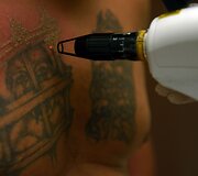 Salvadoro gaujų nariai naikina gaujų priklausomybę žyminčias tatuiruotes, kad pradėtų gyvenimą i&scaron; naujo