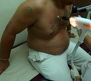 Salvadoro gaujų nariai naikina gaujų priklausomybę žyminčias tatuiruotes, kad pradėtų gyvenimą i&scaron; naujo