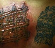Salvadoro gaujų nariai naikina gaujų priklausomybę žyminčias tatuiruotes, kad pradėtų gyvenimą i&scaron; naujo