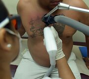 Salvadoro gaujų nariai naikina gaujų priklausomybę žyminčias tatuiruotes, kad pradėtų gyvenimą i&scaron; naujo