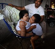 10 mėnesių meksikietis sveria 28 kilogramus, t.y. kaip 9 metų vaikas