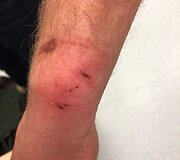 Kaunietis teigia, kad policijos pareigūnai prie&scaron; jį neteisėtai panaudojo jėgą
