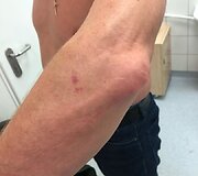 Kaunietis teigia, kad policijos pareigūnai prie&scaron; jį neteisėtai panaudojo jėgą