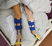 Avarijoje Kėdainių rajone sužalota Antano Jurgaičio dukra