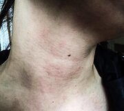 Nepilnametis užpuolė merginą Tauragės mi&scaron;ke